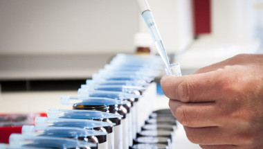 Les PFAS au CEBEDEAU